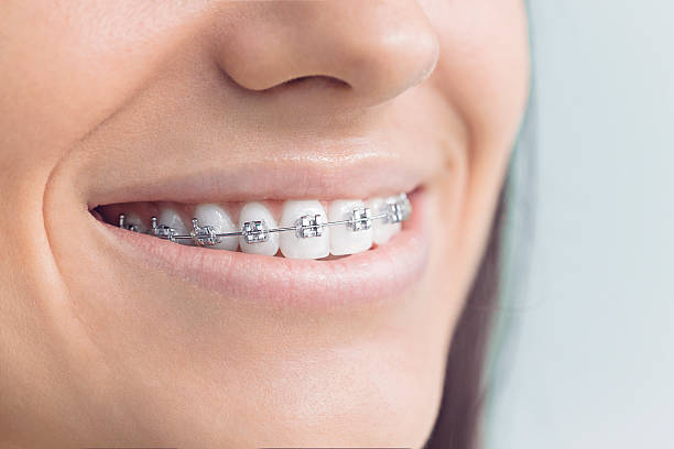 Best Traditional Braces  in Hartsville, TN